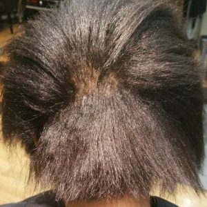 hair-breakage-woman